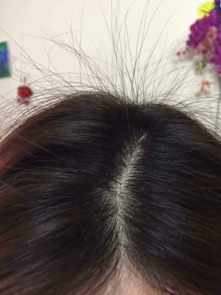 Tôi Đã Lấy Lại Được Mái Tóc Đen Bóng Nhờ Hà Thủ Ô Đậu Đen